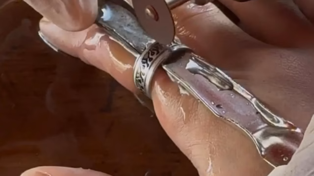 jovem anel preso no dedo