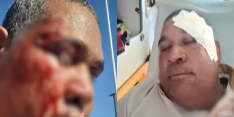 rodoviário atacado salvador