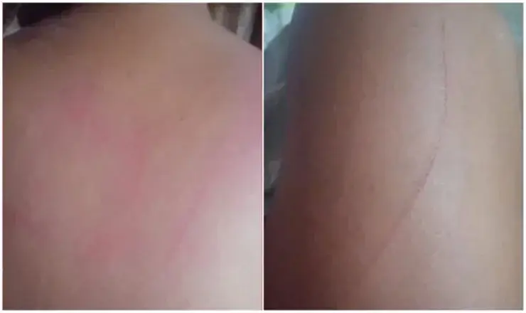 violência Ilhéus estupro