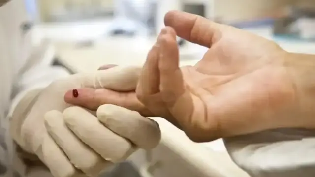 exame HIV Aids HIV/Aids sangue