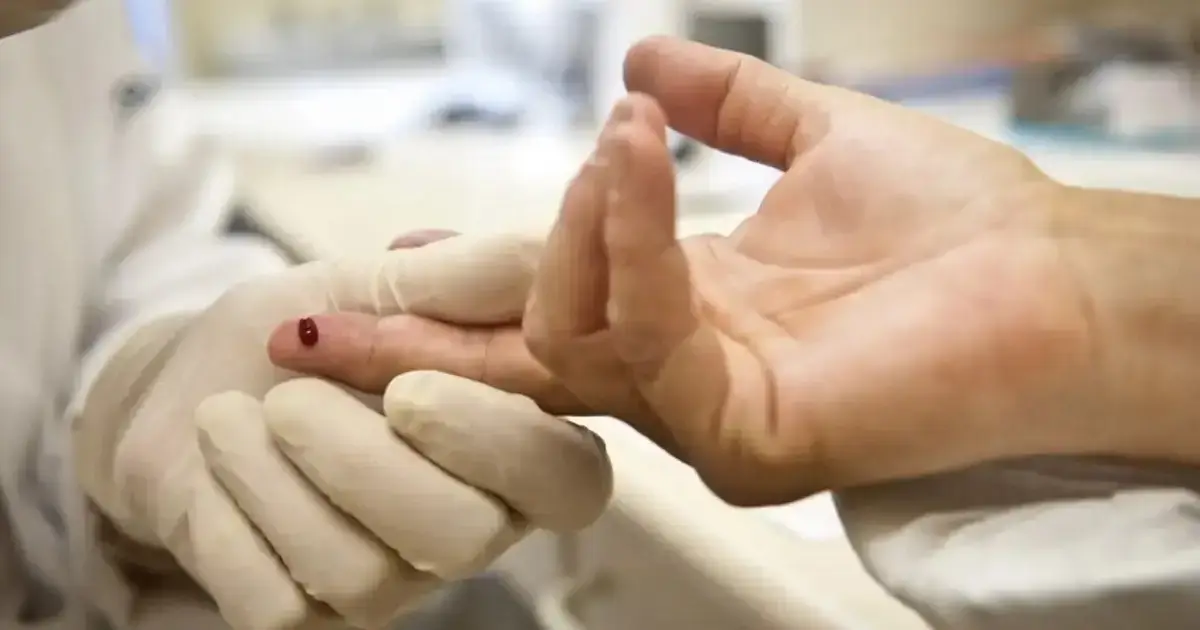 exame HIV Aids HIV/Aids sangue