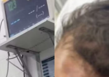 aparelho médico cai na cabeça de bebê em hospital de Aracaju