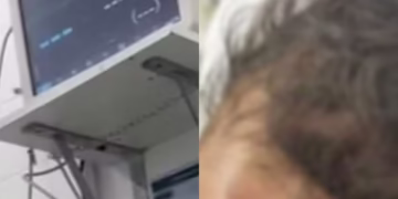 aparelho médico cai na cabeça de bebê em hospital de Aracaju