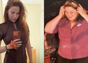 Repórter da Globo detalha sequelas de cirurgia bariátrica realizada na juventude