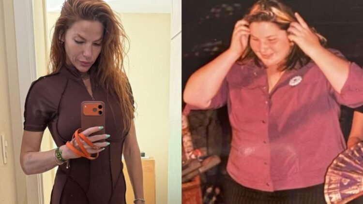 Repórter da Globo detalha sequelas de cirurgia bariátrica realizada na juventude 1 Repórter da Globo detalha sequelas de cirurgia bariátrica realizada na juventude