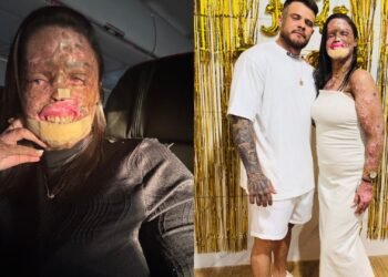 Káh Felipe morre aos 24 anos após batalha contra câncer e doença genética rara