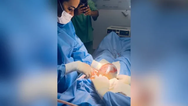 bebê nasceu empelicado em Santo Antônio de Jesus