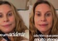 Paula Burlamaqui sofre acidente doméstico e passa por cirurgia no ombro