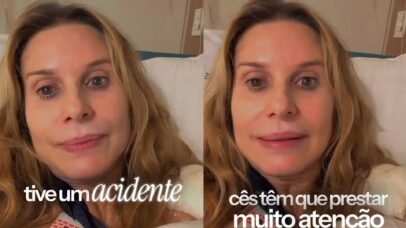 Paula Burlamaqui sofre acidente doméstico e passa por cirurgia no ombro