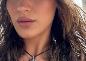Bella Hadid e a luta contra a doença de Lyme: tratamentos e desafios