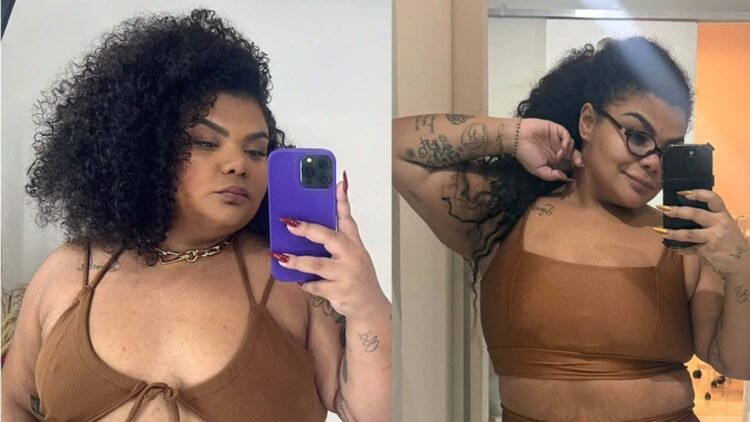 Influenciadora Flora Cruz elimina mais de 40 kg com foco na saúde e revela segredo médico