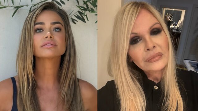 Lifting facial ganha destaque com famosas e médico detalha técnicas